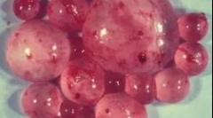 Kaj je echinococcus in kako se ukvarjati z njim